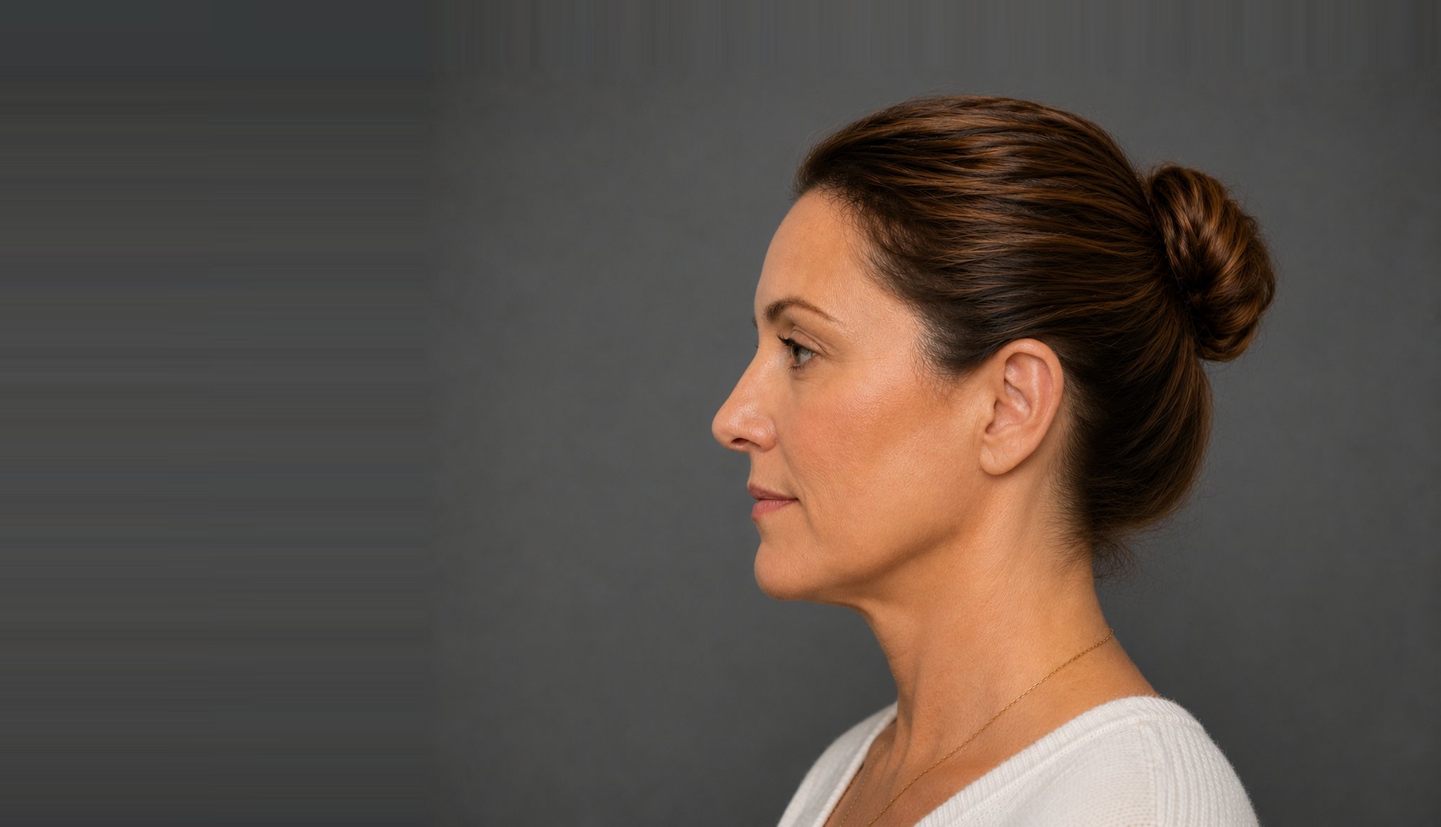 Patient after a custom ear prosthesis, natural appearance restored