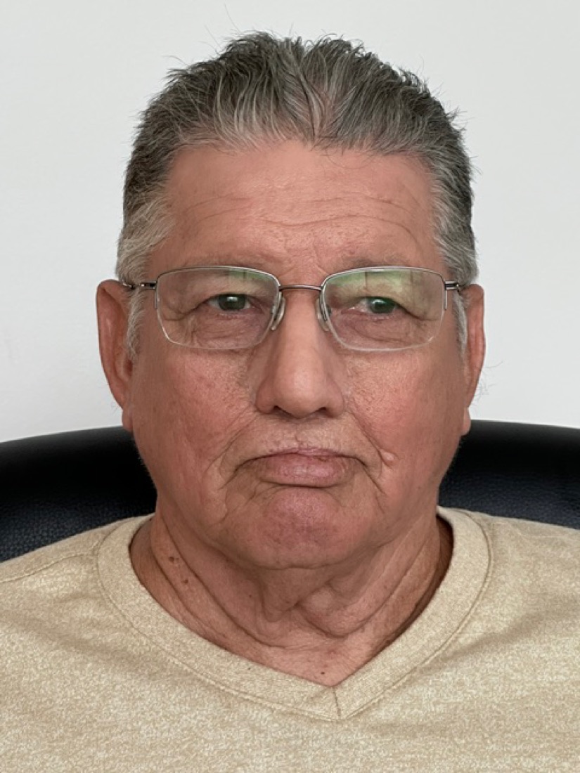 Patient after a custom silicone nasal prosthesis color-matched to the surrounding skin