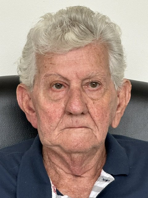 Patient after a custom orbital prosthesis restoring a natural appearance